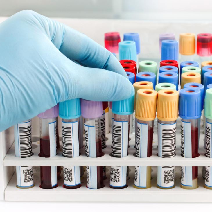Vacutainer Blood Tubes